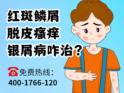 寒湿导致牛皮癣