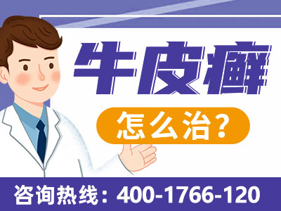 郑州市有治疗银屑病的正规医院吗